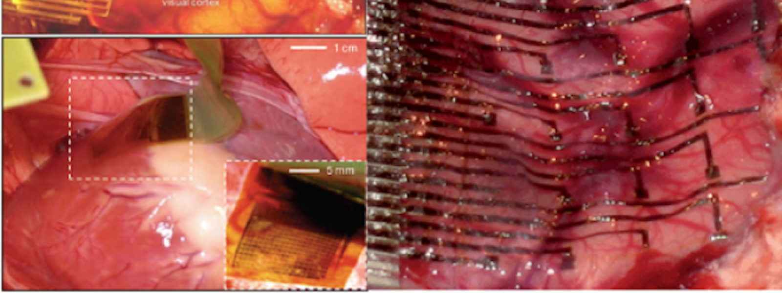 Flexible, Ultrathin Sensors for Biomedical Applications