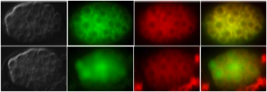 Mitochondrial Cell Death