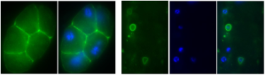 Phospholipid Asymmetry