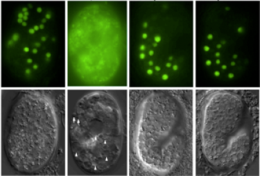 Hepatitis Virus B