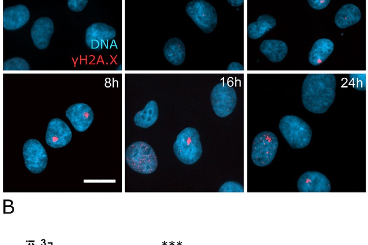 DNA damage foci form rapidly after SINE treatment.