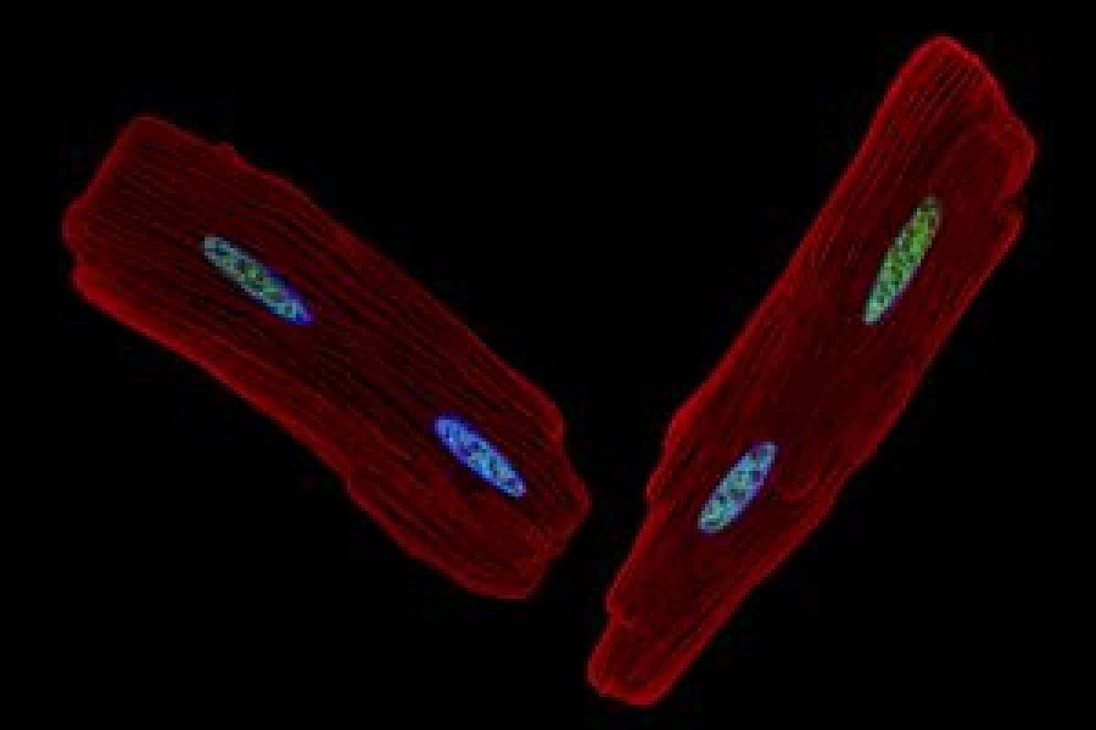 Heart muscle cells.