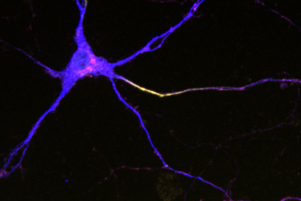 Image of neuron.