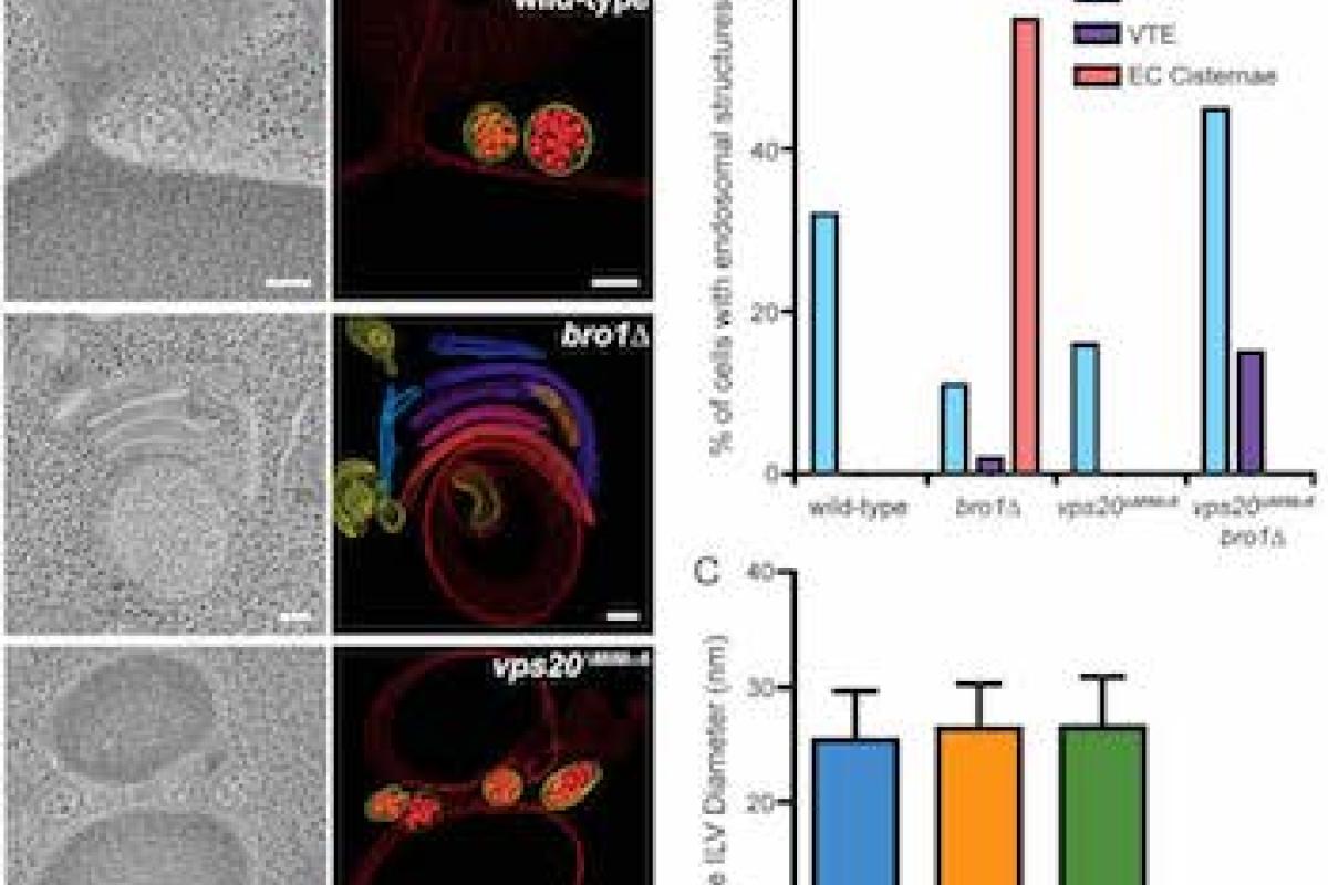 Mutation of Vps20 MIMa6 rescues ILV budding defects in bro1D cells.