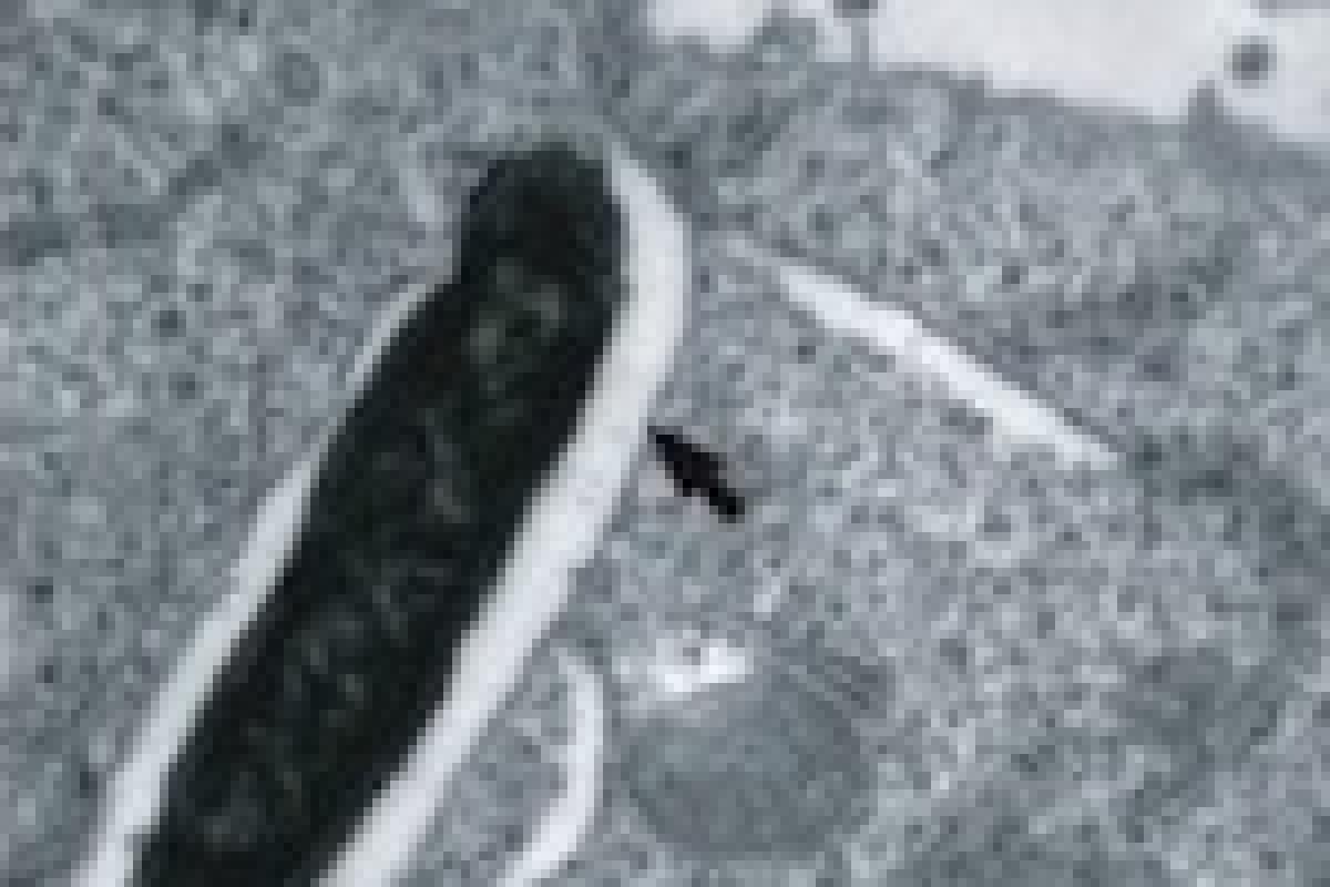 Image of salmonella.