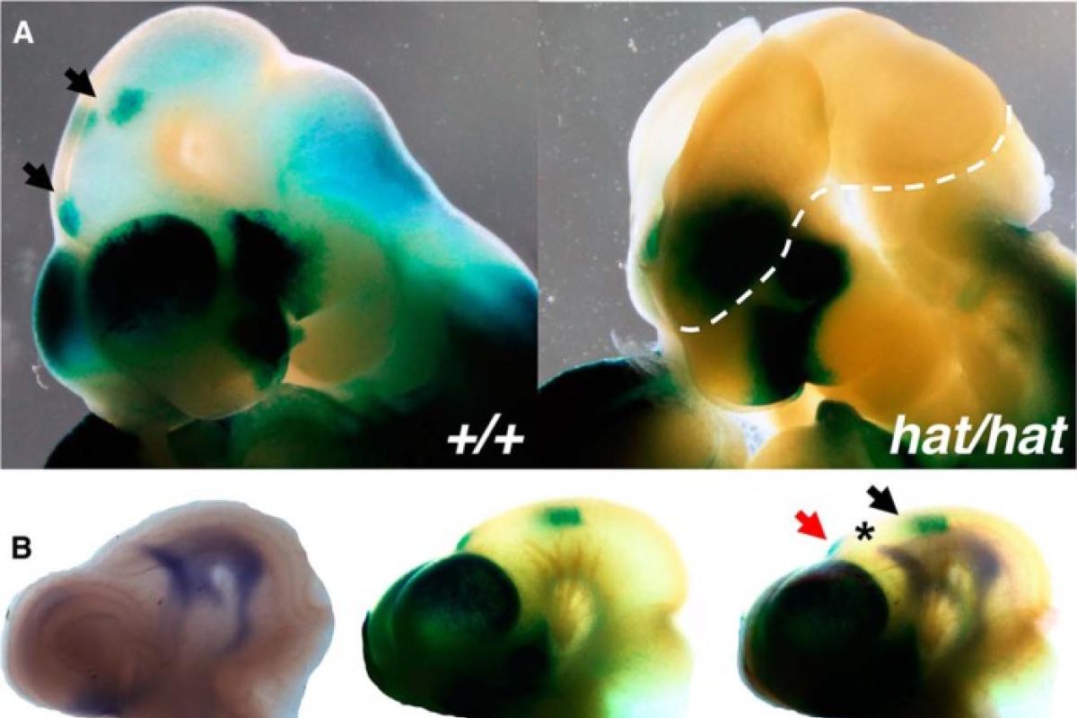 GCN5 acetyltransferase activity is required for RA signaling in the developing forebrain.