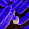 E. coli (Credit: NIH)
