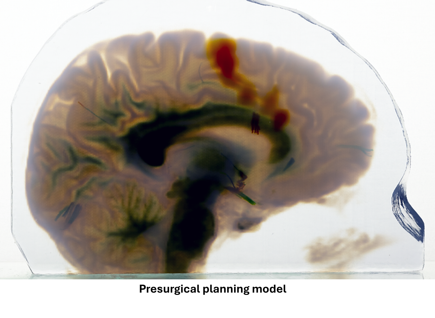 multi-colored sketch outlining a human brain