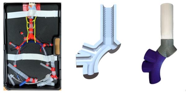 3D Printed Respiratory System