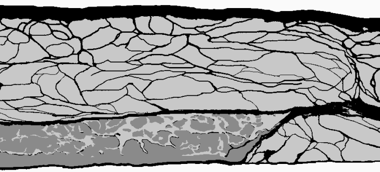 Cross section of abdominal wall