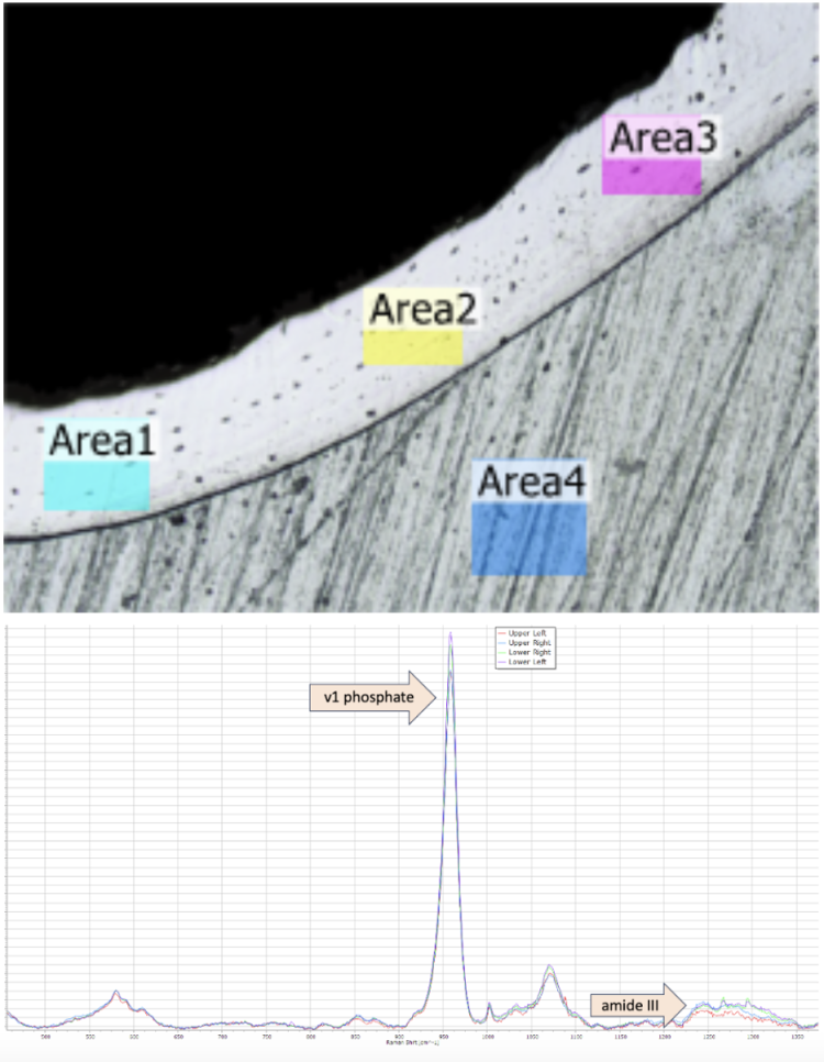 Anterior-lateral portion of mid-diaphysis mouse femur cross-section. Taken using a Keyence Microscope to perform analysis of surface roughness to enable collection of Raman spectra.