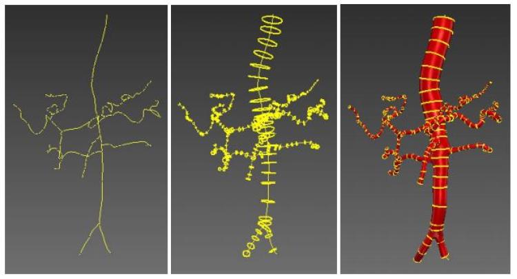 Process of creating a patient-specific model from CTA images on Simvascular