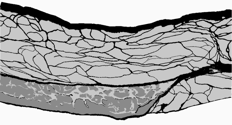 The results of the finite element analysis are used to construct an image of the compressed abdomen
