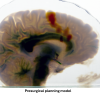 multi-colored sketch outlining a human brain