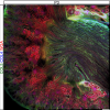 Microscopic view of the kidney 