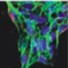 mechanics of cancer