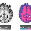 Brain Scans