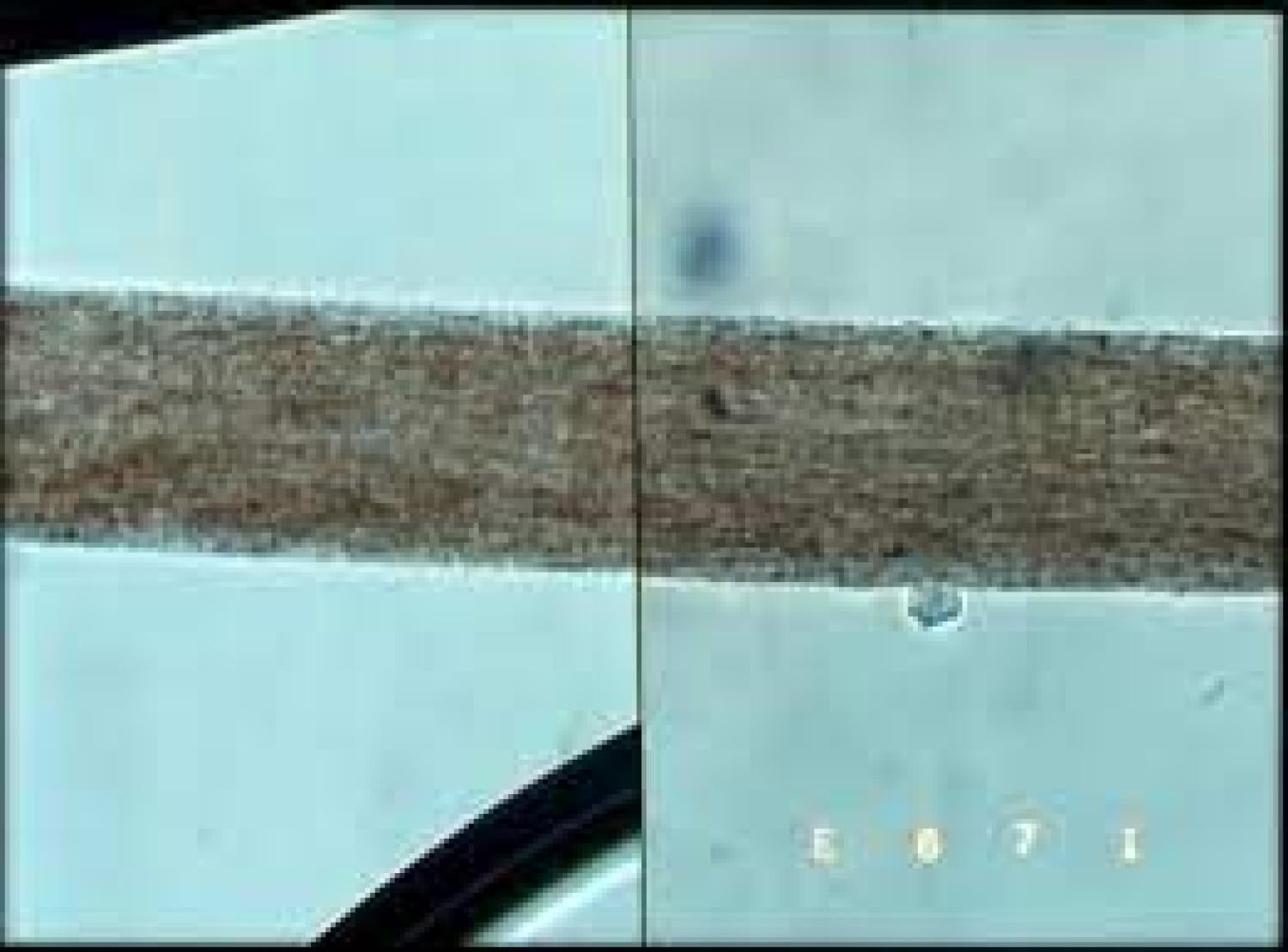 hair microscopy