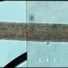hair microscopy