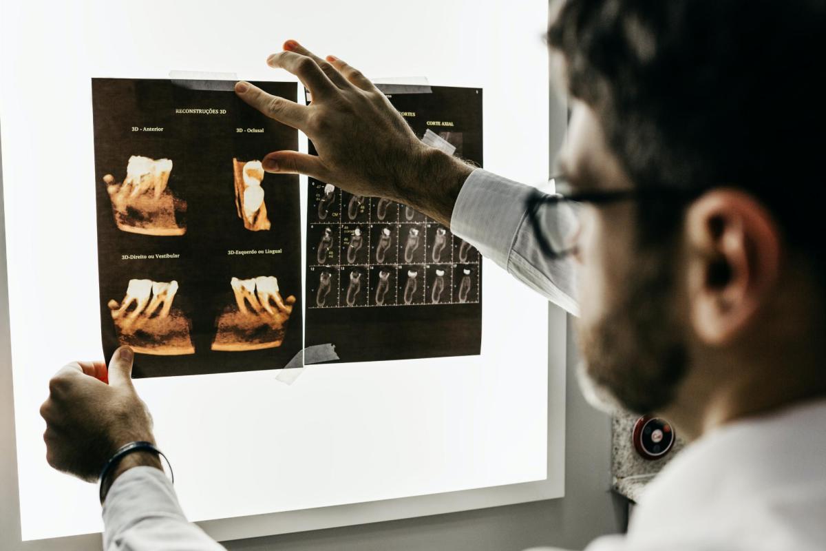 A dentist analyzes x-ray images of teeth.