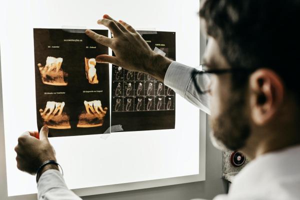 A dentist analyzes x-ray images of teeth.