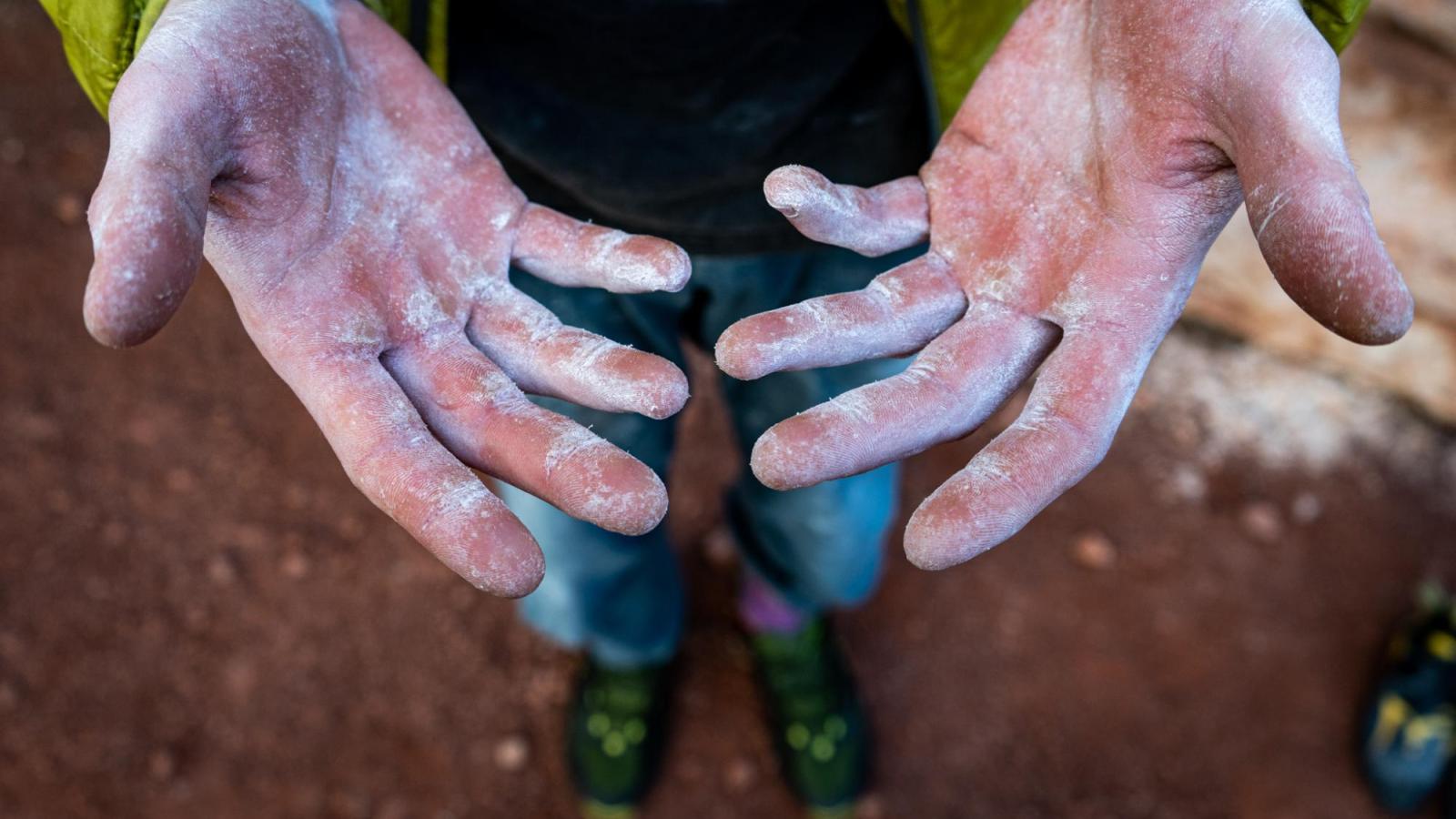 A climber’s chalky cut hands contrasted by green jacket and shoes