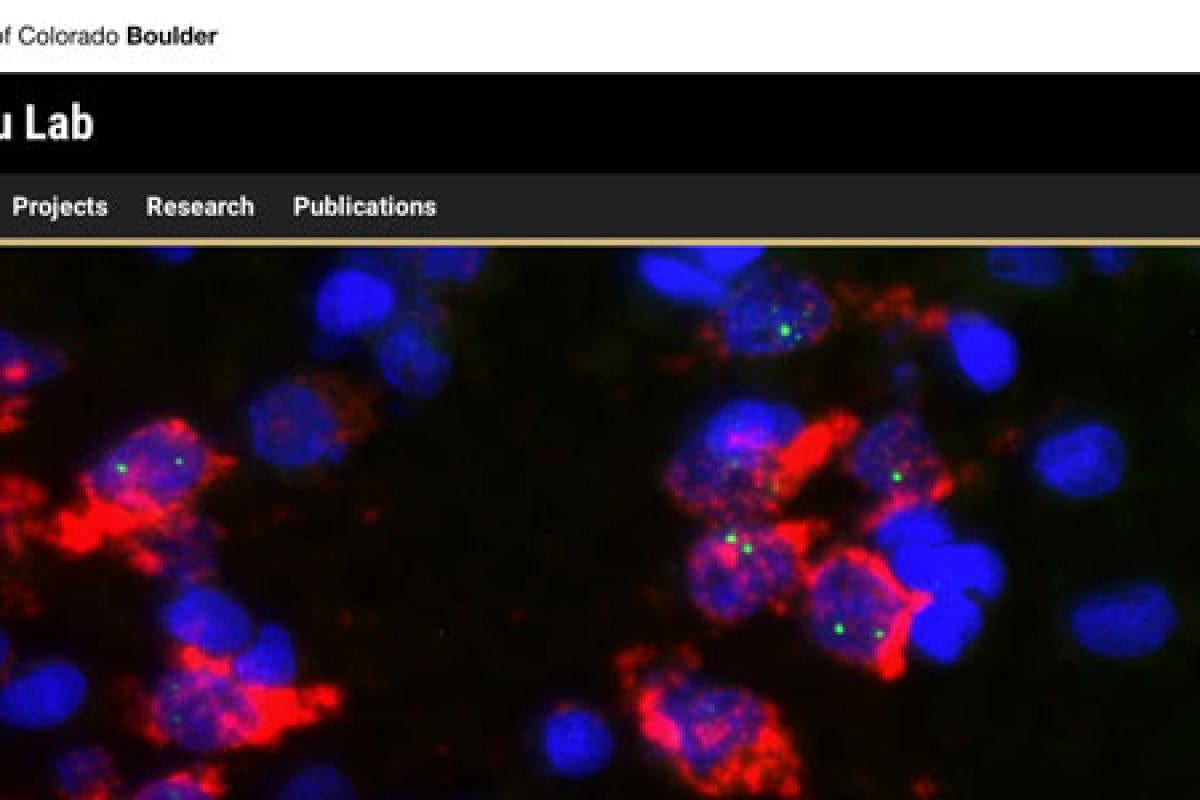 Stained neuron image
