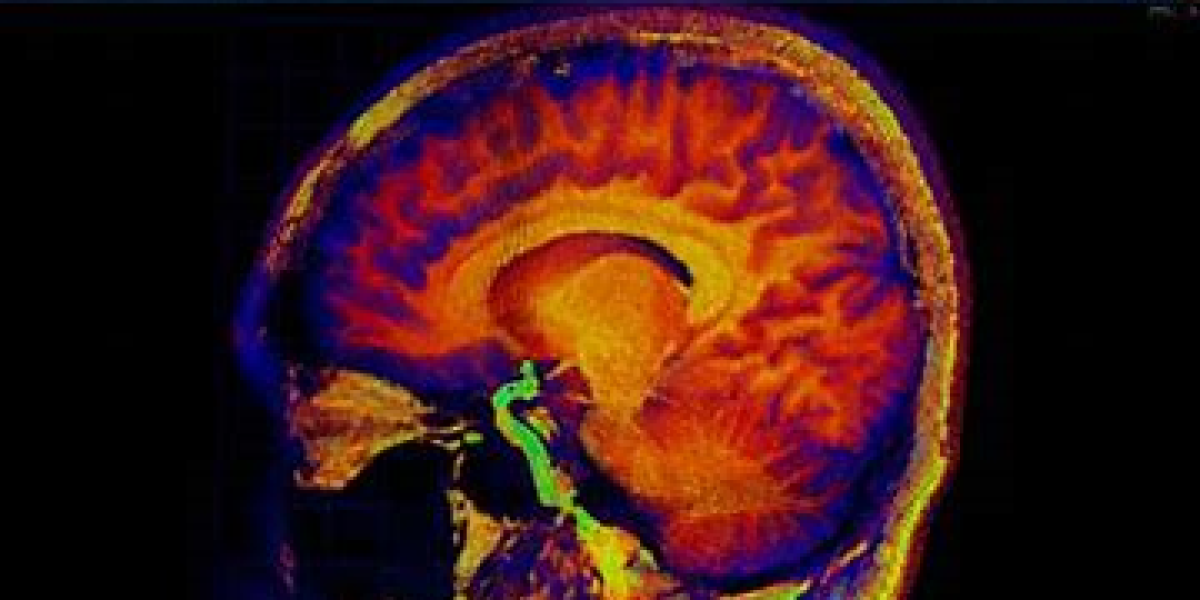 rainbow image of brain