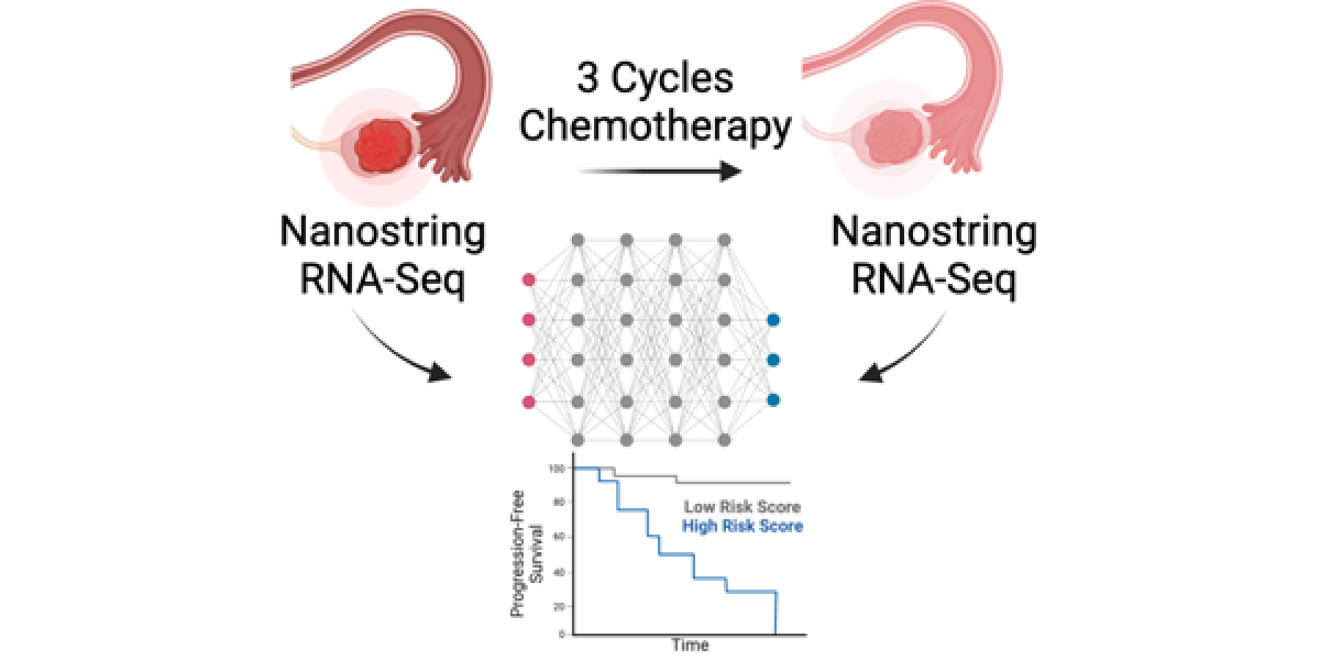Using advanced computational analysis to predict ovarian cancer outcomes