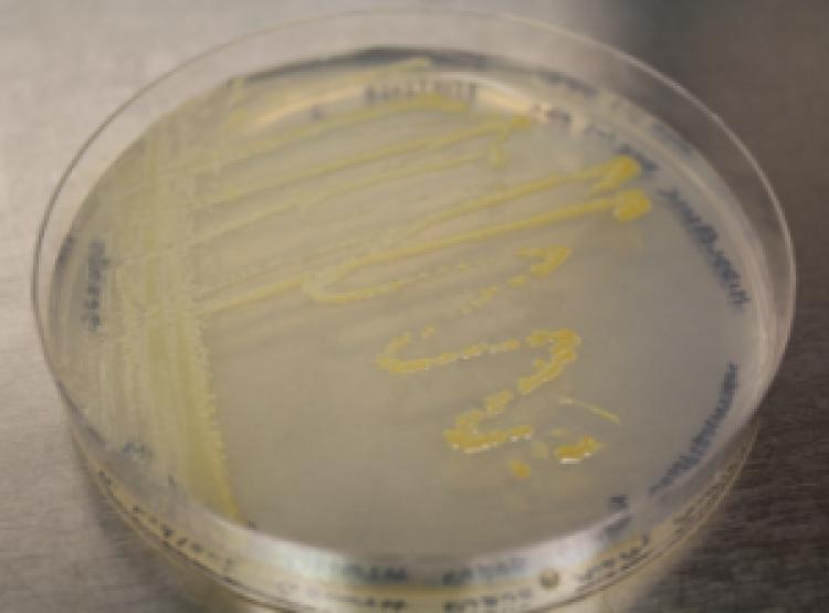 Photo of a petri dish