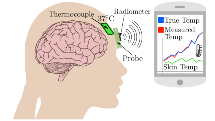 Noninvasive brain temperature monitoring illustration