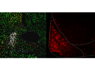 Cell-type, pathway and neurotransmitter-specific regulation of feeding circuitry