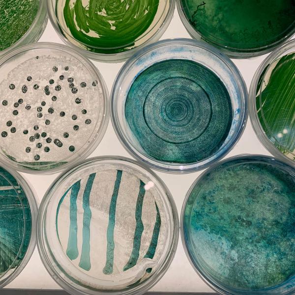 Four different species of cyanobacteria