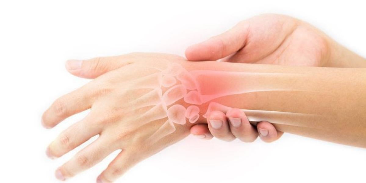 Illustration of pain in a person's wrist