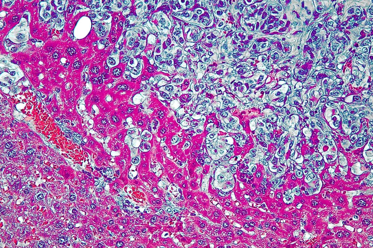 Microscopic image of cells stained pink