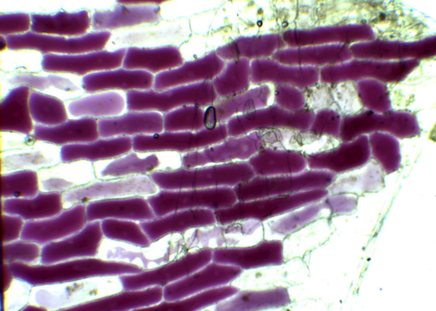 onion skin cells
