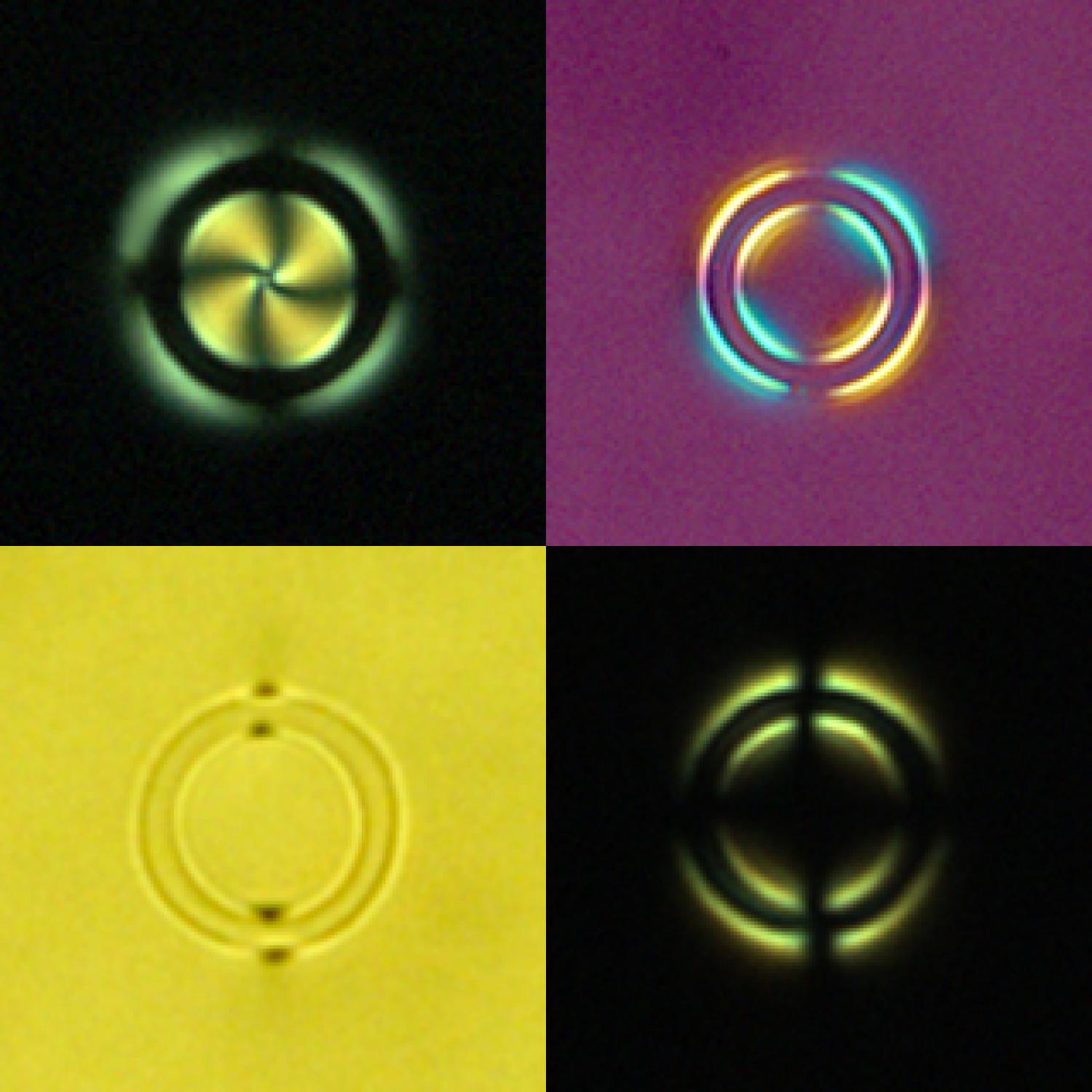 Handlebody in liquid crystals