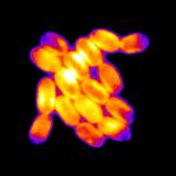 Individual cells in a cyanobacterial colony fluoresce