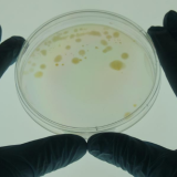 A researcher examines a sample of Mycobacterium vaccae