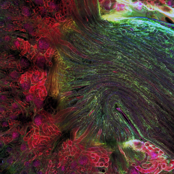 3D renderings of post-natal kidneys