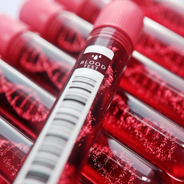 Vials of blood