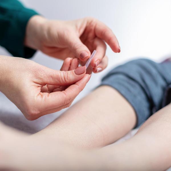 person receiving acupuncture