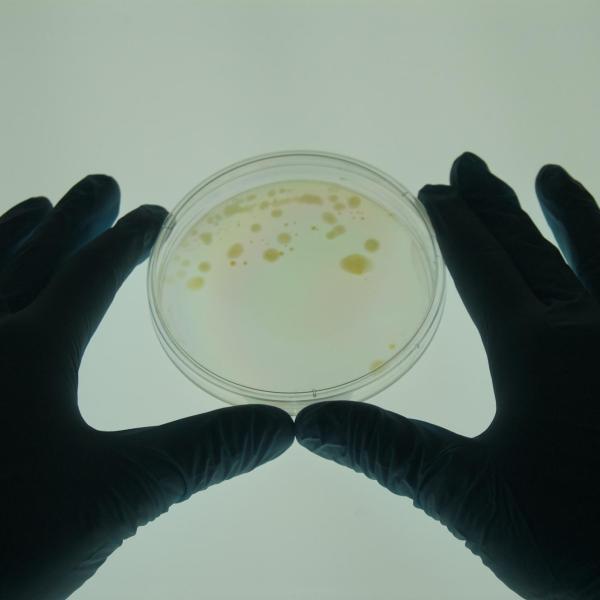 Microbacterium vaccae