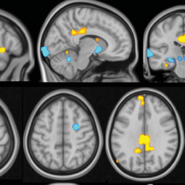 an image of MRI brain scans