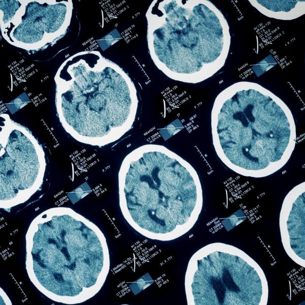 Brain images