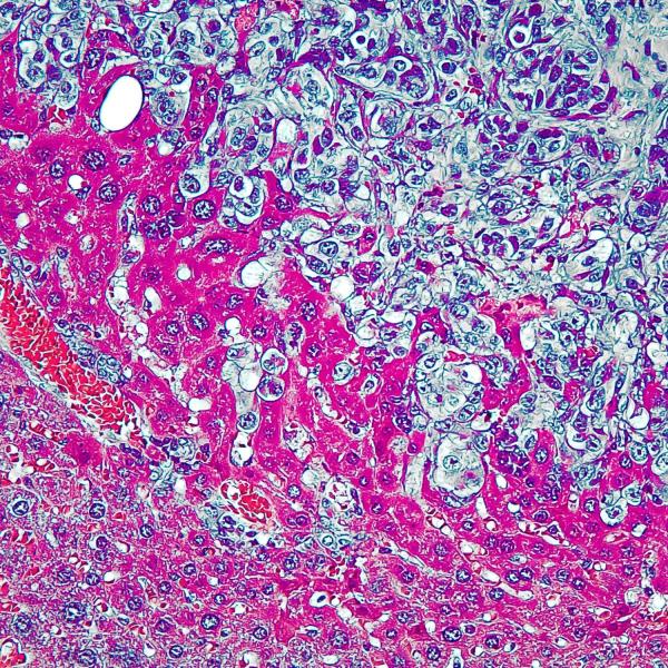 Tissue stained pink seen under a microscope