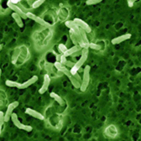 A green image of M Vaccae under the microscope