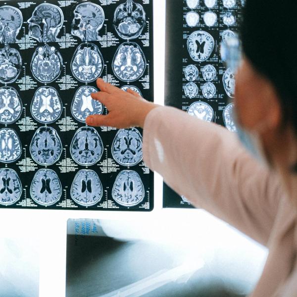 researcher examines brain scans