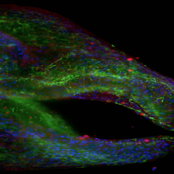 An image of a specimen under a microscope