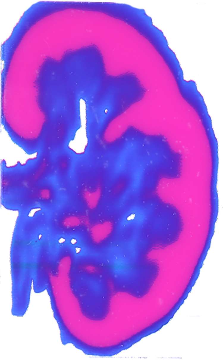 Digital representation of a cross-section of the kidney